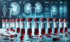 Kidney Blood Test Guide for Residents of Blackburn