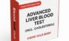 Advanced Liver Blood Test Guide for Residents of Maidstone