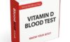 Vitamin D Blood Test Essential for Residents of Lincoln